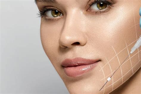Thread Lift in Chandigarh – Face, Cheek & Fox Eye Lift with Aptos Cog ...