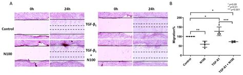 Niclosamide Attenuates Inflammation-Associated Profibrotic Responses in ...