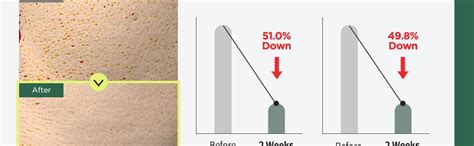 ANUA Heartleaf 77 Clear Pad 70 Sheets, Pha Dead Skin Care Low Ph Daily ...