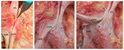 Anatomical Relationships of the Proximal Attachment of the Hamstring ...