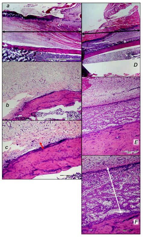 Stable Gastric Pentadecapeptide BPC 157 as Therapy After Surgical ...