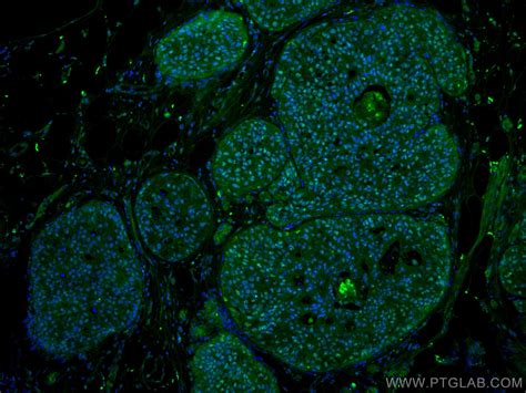 PELP1 antibody (67050-1-PBS) | Proteintech