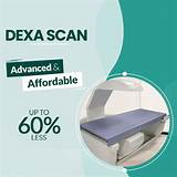 DEXA Scan | Bone Mineral Density Scan - Aarthi Scans & Labs
