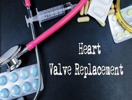 Which Valve Replacement is Suitable: Metallic or Tissue (Animal) Valve ...