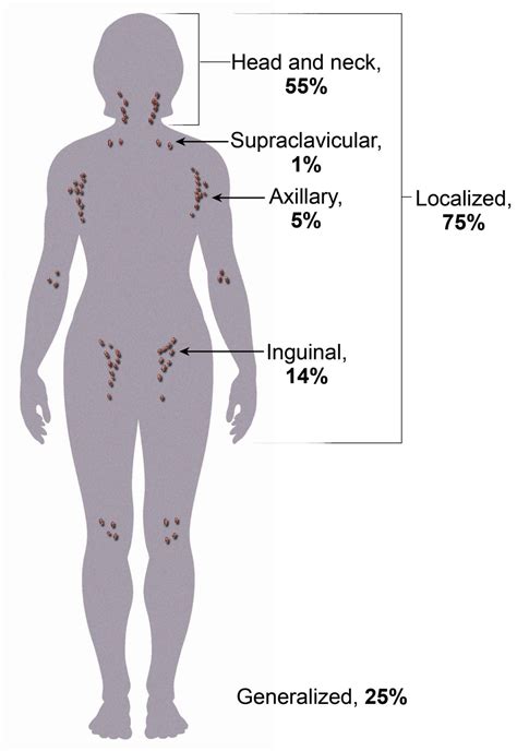 Lupus supraclavicular lymph nodes swollen - govrilly