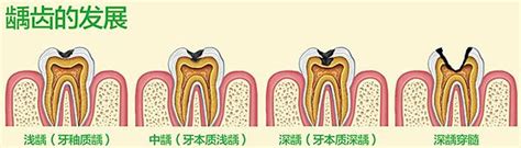 牙体牙髓科_郑州市二七区长城口腔门诊部