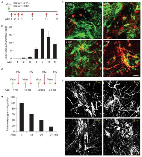 Image result for Astrocyte Neuron Reprogramming