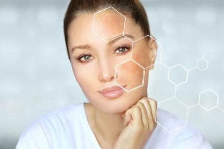 Hyperpigmentation Pictures | Photo Gallery Of Skin Pictures | The Pink ...
