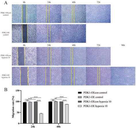 Study on the Regulatory Mechanism of the PDK1-Mediated TGF-β/Smad ...