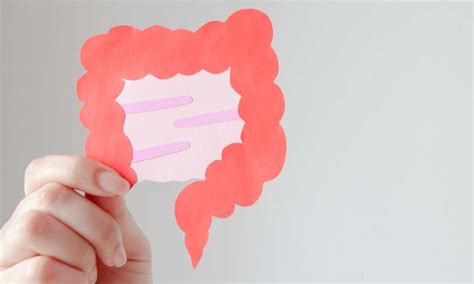 Probiotics with laxatives improve functional constipation in children ...