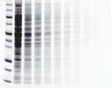 iBright Imaging Systems Features | Thermo Fisher Scientific - IN