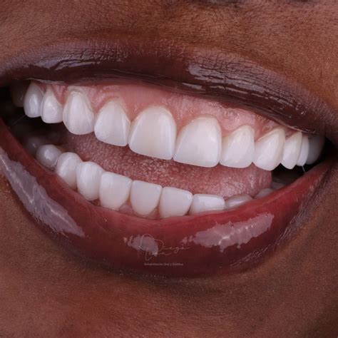 Diego Leon (@clinicadrdiegoleoncolombia) • Instagram photos and videos