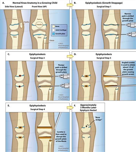 Image result for Appendix with Screen Shot Example