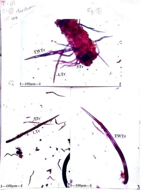 Fig. 3.1, 2, 3 Fig. 4.1, 2, 3