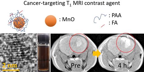 In Vivo Positive Magnetic Resonance Imaging of Brain Cancer (U87MG ...