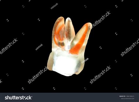 Right First Maxillary Upper Molar Tooth Stock Photo 1386168221 ...