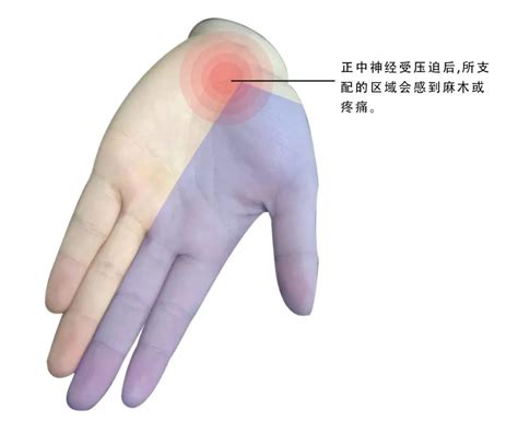 可怕的手指发麻预示这10种疾病，还不重视?_凤凰网健康_凤凰网