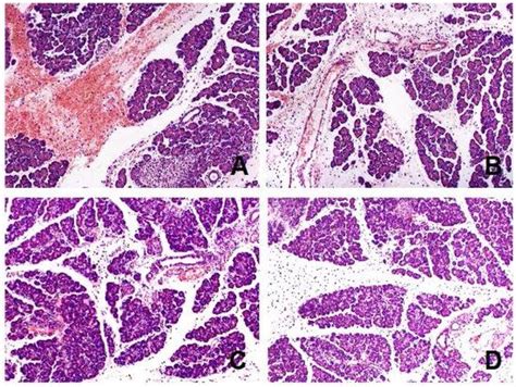 Therapeutic Effect of Low Doses of Acenocoumarol in the Course of ...
