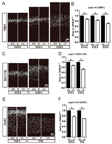 TRIM32 Deficiency Impairs the Generation of Pyramidal Neurons in ...