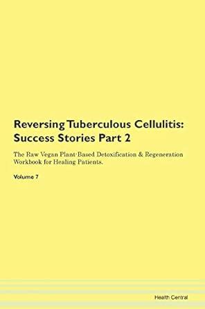 Reversing Tuberculous Cellulitis: Succes : Central, Health: Amazon.in ...