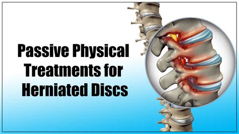 What is Herniated Disk, & How Can Physical Therapists Help in the Fastest Recovery? - Oklahoma ...