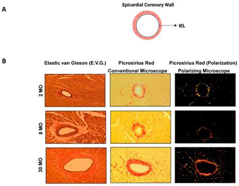 Unraveling Elastic Fiber-Derived Signaling in Arterial Aging and ...