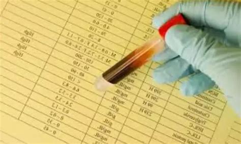 Study Reveals Link Between TyG Index and Heart Failure with Preserved ...