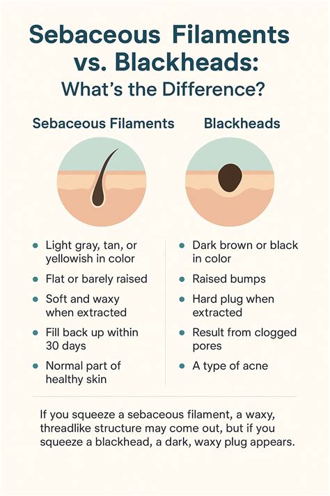 Sebaceous Filaments Vs Blackheads