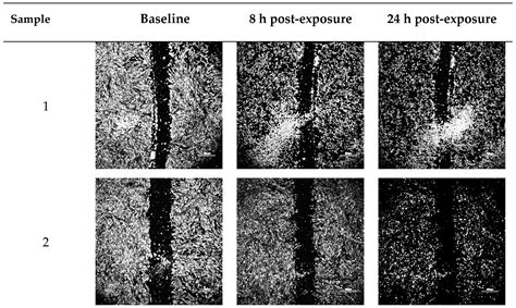 In Vitro Assessment of Wound-Healing Efficacy of Stabilized Basic ...