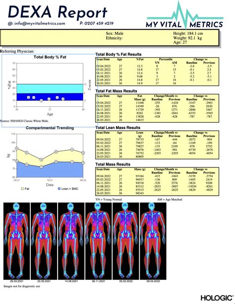 Dxa Scan Results
