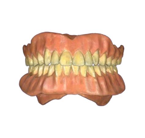 Full Denture