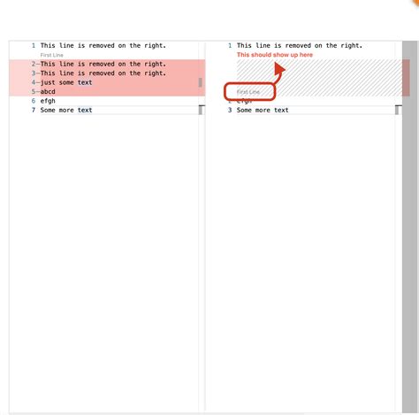 Image result for CodeLens Monaco