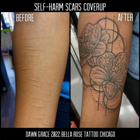 Self Harm Scars Legs