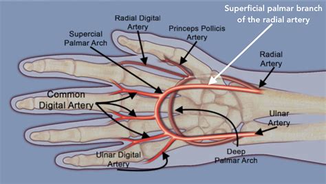 Superficial Arch and Superficial Branch of Radial Artery | Anatomic Structures at Risk