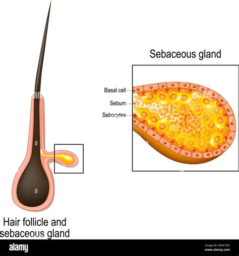 Prominent Sebaceous Glands Anus