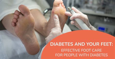 How To Prevent Diabetic Feet Problems? | MrMed