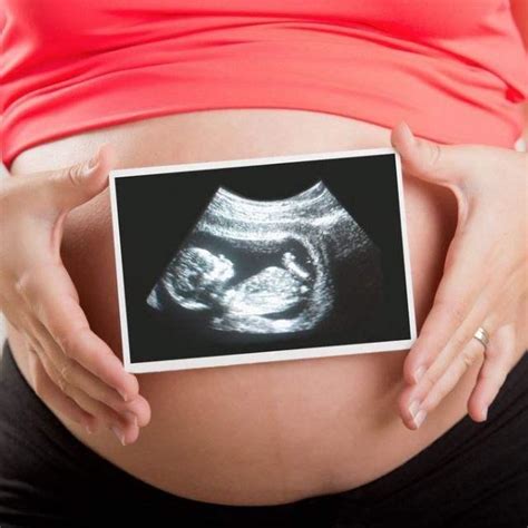 四维大排畸遇到这些“情况”，不一定说明胎儿有问题，孕妈别担心_妈妈