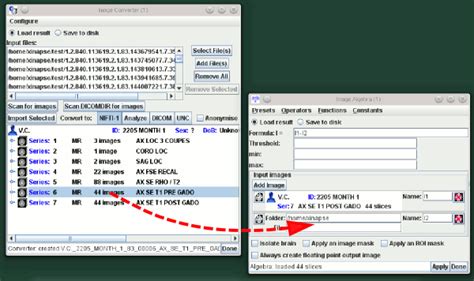 DICOM Query Retrieve Tool 的图像结果
