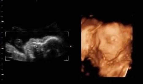怀孕16周胎儿真实图片 孕期宝宝发育过程图片_知秀网