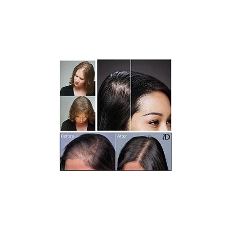 Volumon Hair Loss Concealer and Root Cover Up - Make India | Ubuy