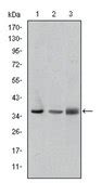 Anti-LIMS1, clone 5G7 Antibody ascites fluid, clone 5G7, from mouse ...