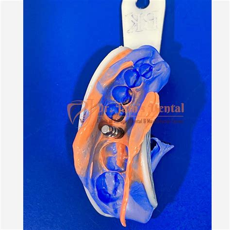 Gallery | The Best Dr. Jain's Dental in Sector-75 Noida