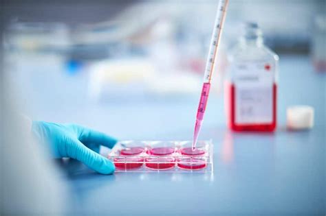 Europe Cell Culture Media Market on the Rise $1,453.2 Mn