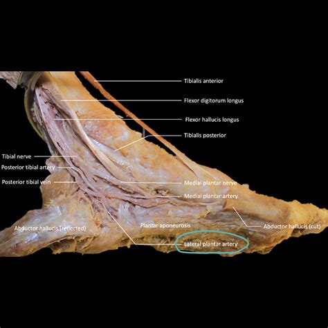 Plantar Foot Arteries at Claudia Wade blog