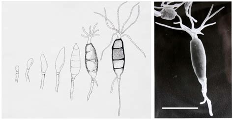 The Emergence of Endophytic Microbes and Their Biological Promise