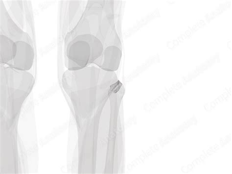 Superior Tibiofibular Joint (Left) | Complete Anatomy