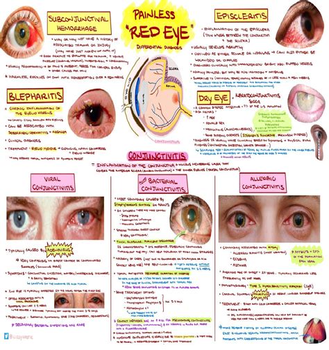 Eye Pain Explained: Causes, Diagnosis – WDXO