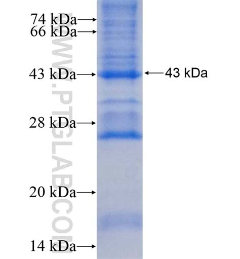 MXD3 Fusion Protein Ag0104 | Proteintech