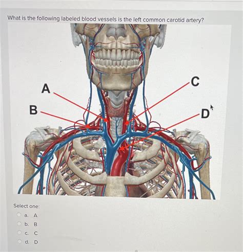 Left Common Carotid Artery