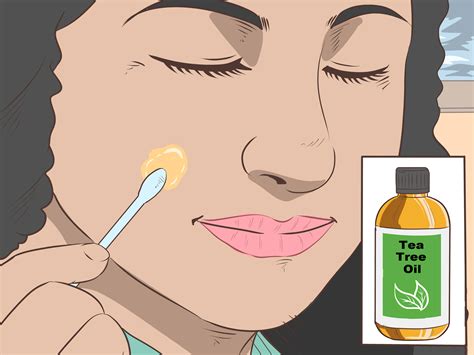 How to Remove Moles Without Surgery (with Pictures) - wikiHow